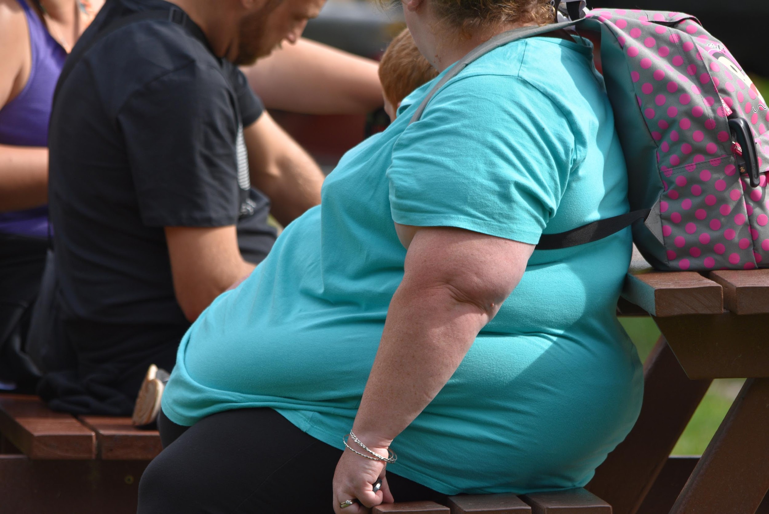 Cirugía, una oportunidad para manejar la obesidad mórbida en México