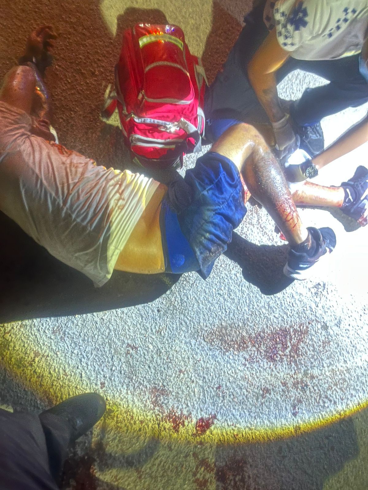 Tras ser herido en la pierna, joven motociclista es sometido con fuerza excesiva de parte de los policías que lo hirieron.