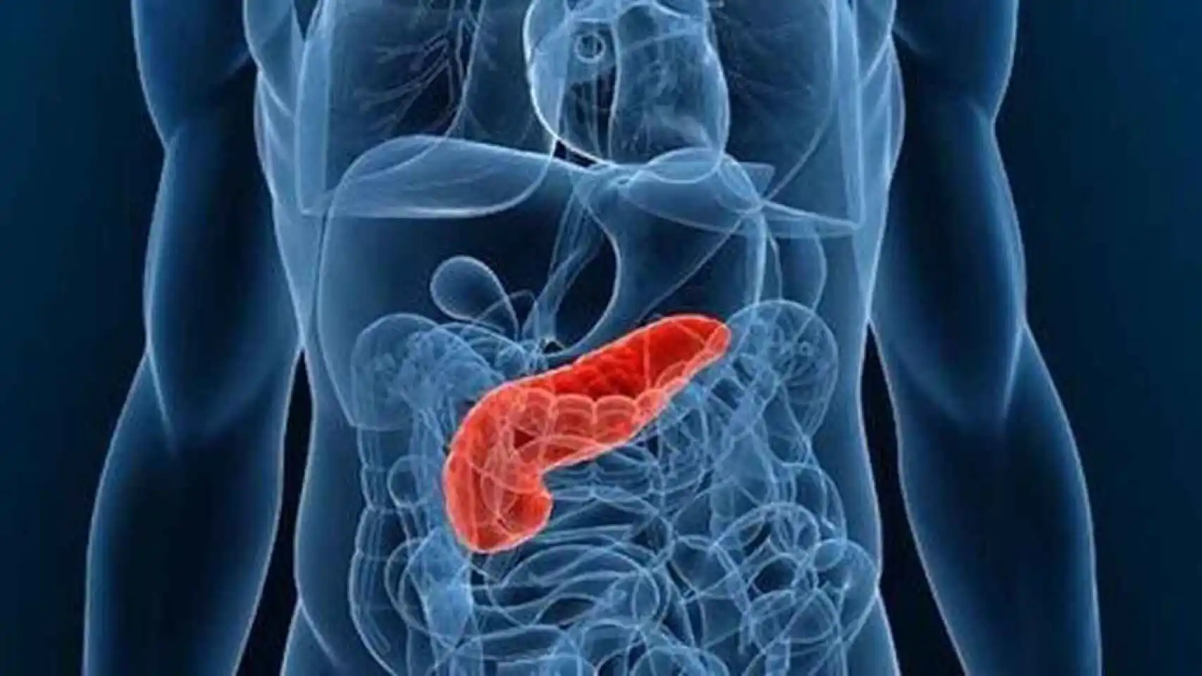 Cáncer de páncreas