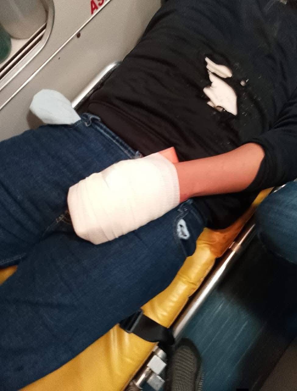 Explosión de petardo