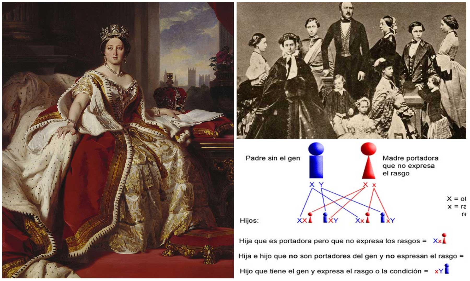 Reina Victoria I era portadora asintomatica de la Hemofilia I