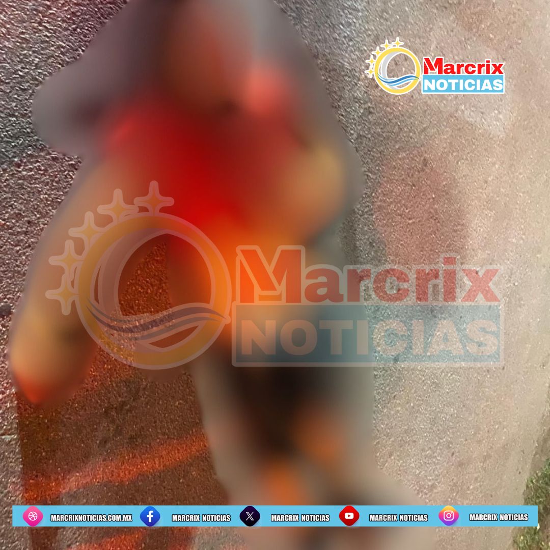 Baleado en Leona Vicario
