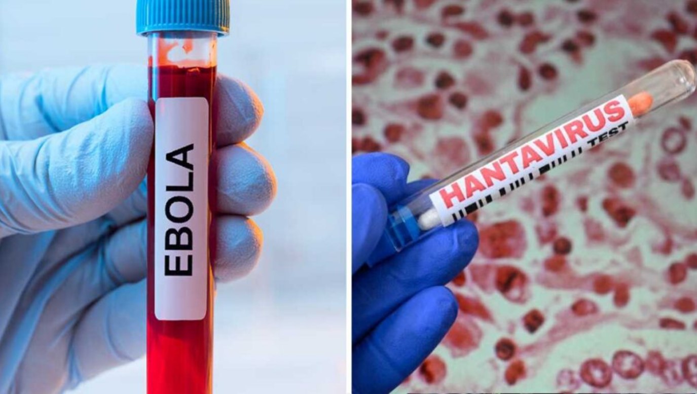 Descartan casos de hantavirus y ébola en Quintana Roo
