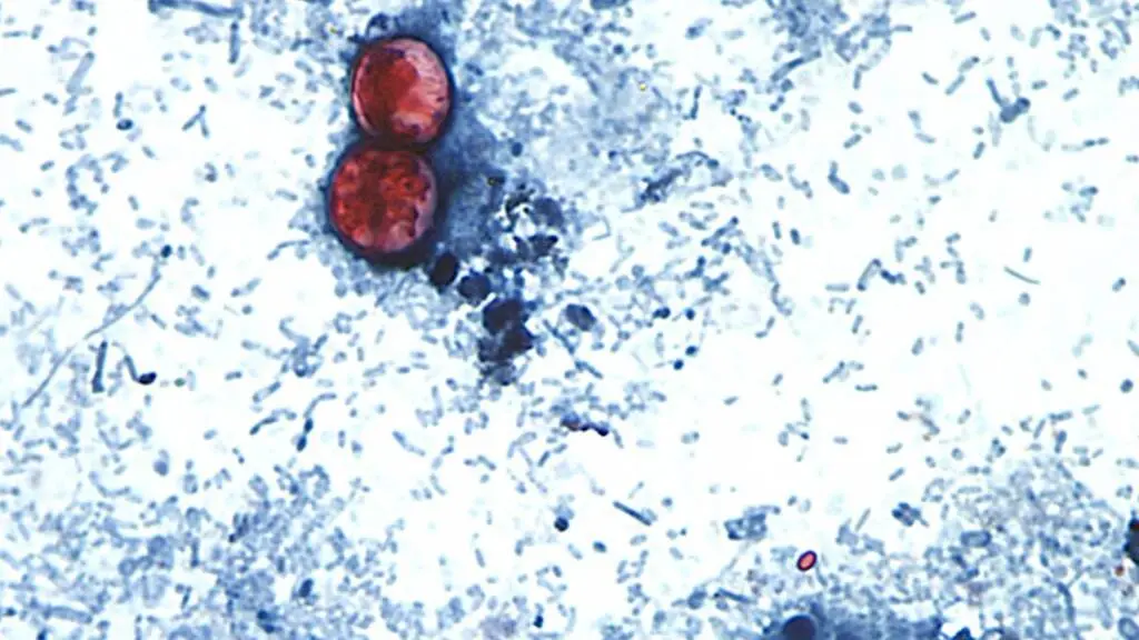 Brote de ciclosporiasis dispara alertas sanitarias en Estados Unidos