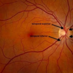 Científicos logran regenerar vasos sanguíneos de la retina con células madre